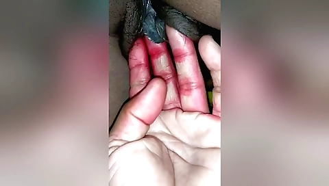 Indian hairy girl 18 years old is on camera with her face